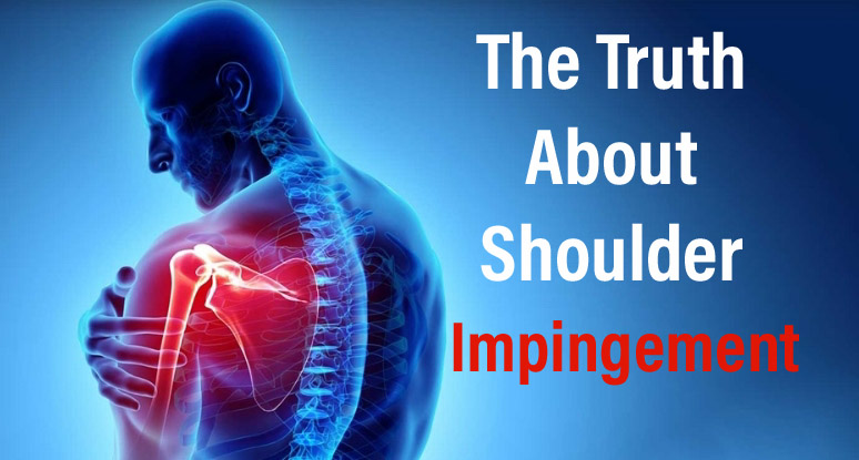 The Truth About Shoulder Impingement